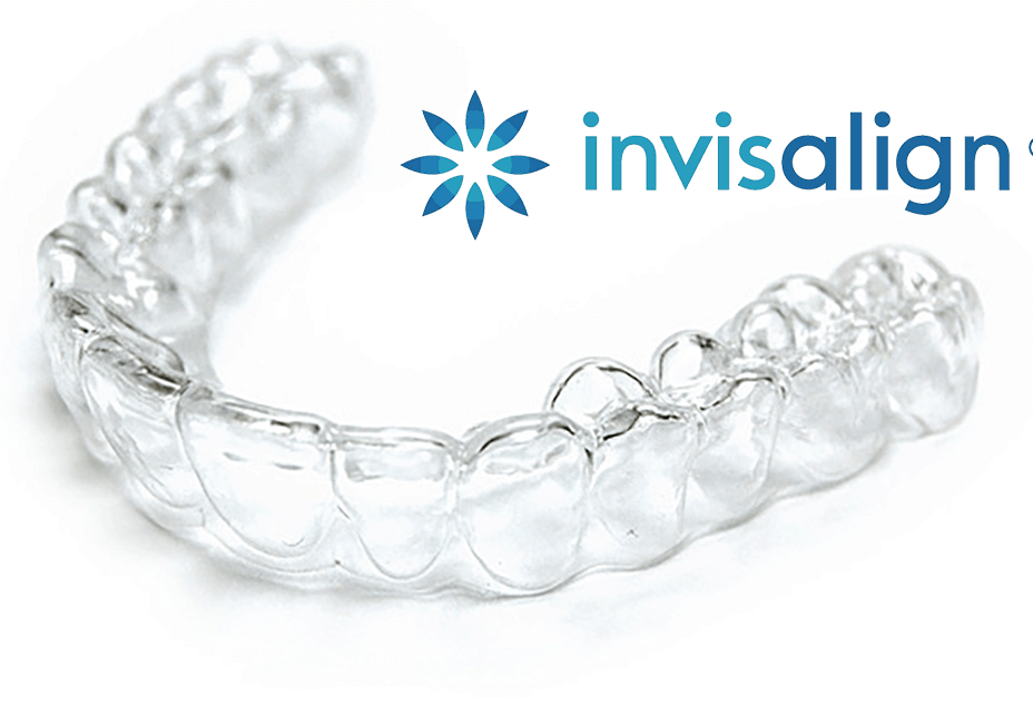 invisalign-image2